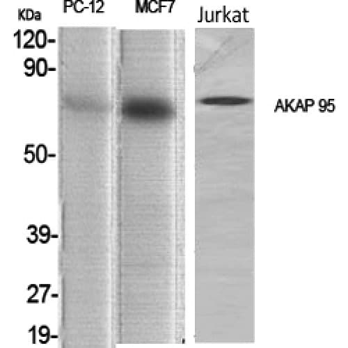 AKAP8 / AKAP95 Antibody (300-380 aa, Internal)