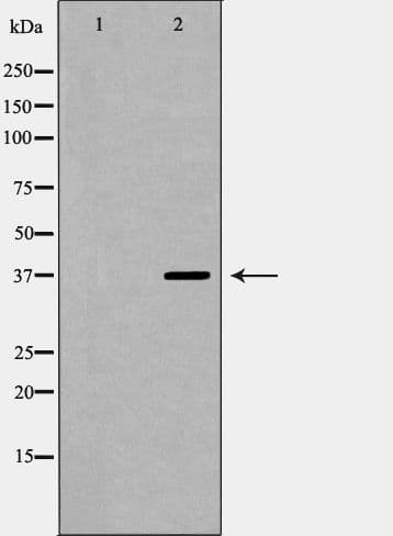 SORD / Sorbitol Dehydrogenase Antibody
