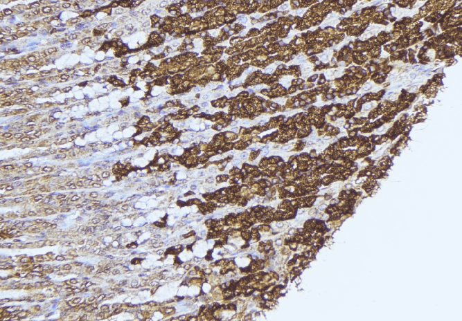 Polyclonal Rabbit anti-Human PCCB Antibody (IHC, WB)