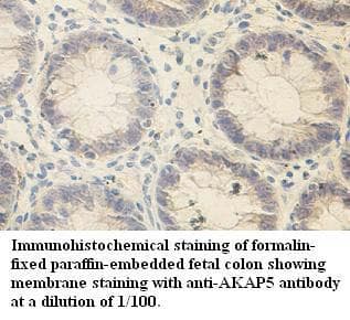 AKAP5 / AKAP79 Antibody (aa171-417)