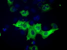 IGF2BP2 Antibody (clone OTI3F9)