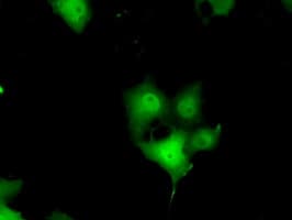ERCC1 Antibody (clone OTI1B3)