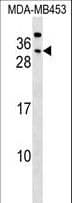 IHC-plus™ CEACAM7 Antibody (aa112-140)