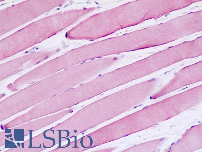 IHC-plus™ Polyclonal Rabbit anti-Human MSH3 Antibody (aa51-100, IHC, WB)