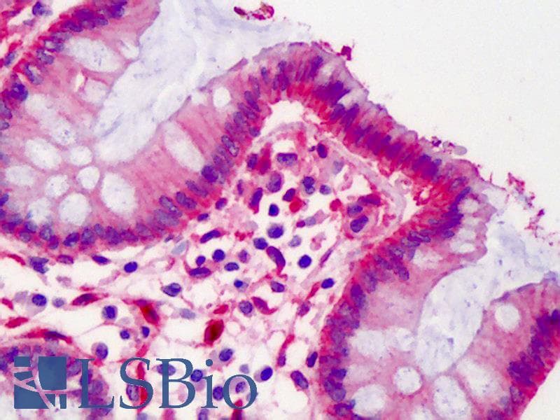 IHC-plus™ lpp Antibody (clone 8B3A11)