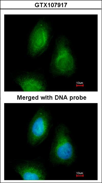 SEPHS2 Antibody (aa186-448)