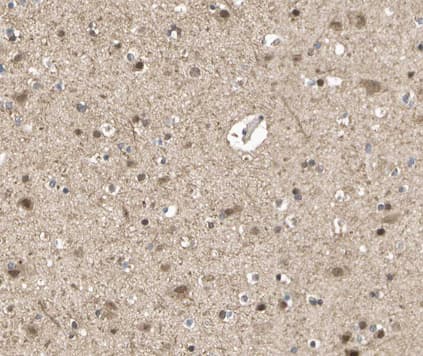 GRM7 / MGLUR7 Antibody