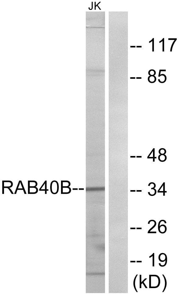 RAB40B Antibody