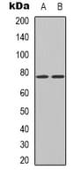 HNRPM / HNRNPM Antibody (N-Terminus)