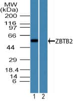 IHC-plus™ ZBTB2 Antibody (aa450-500)