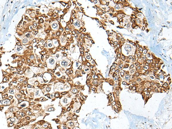 Polyclonal Rabbit anti-Human USP12 Antibody (IHC)