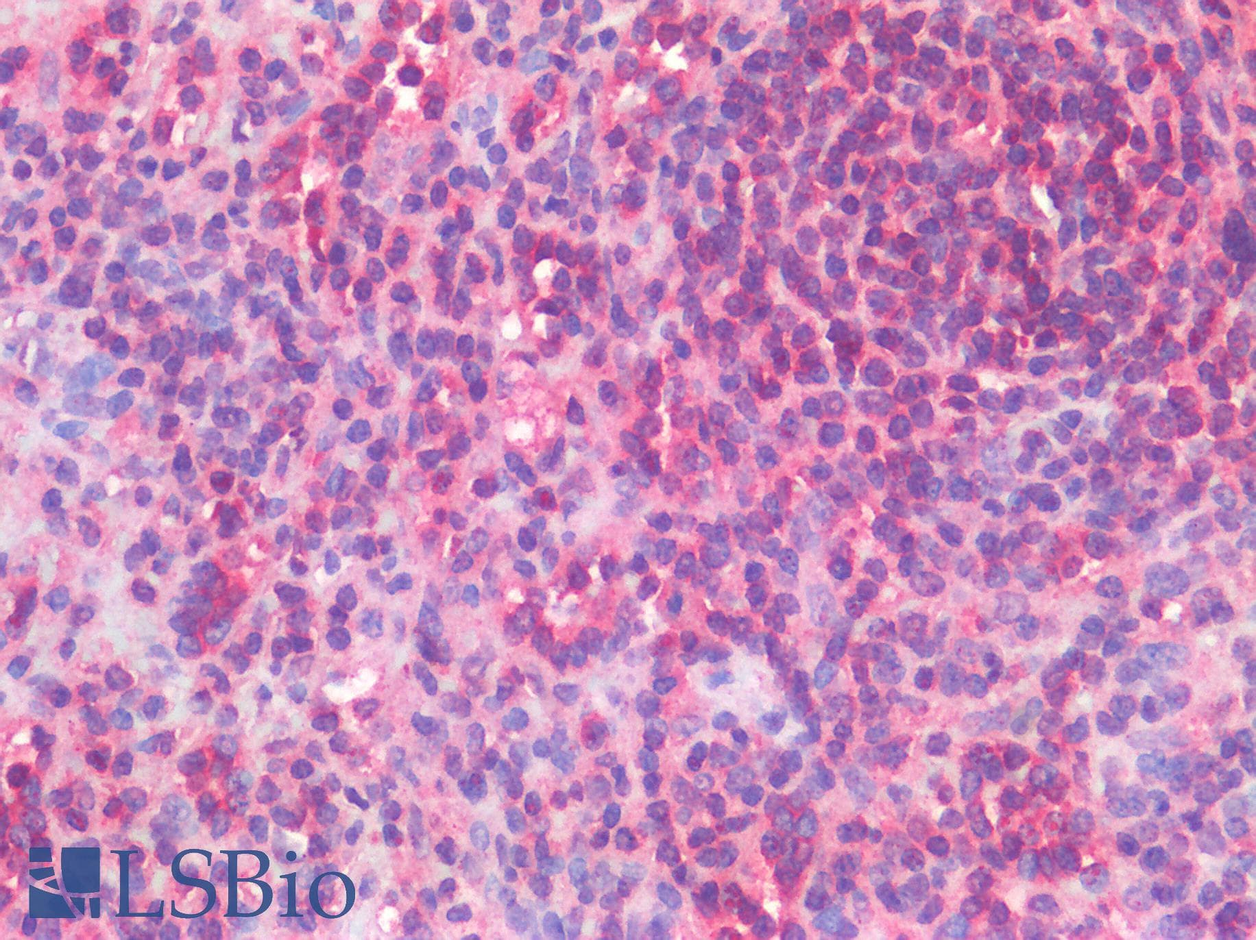 IHC-plus™ Polyclonal Rabbit anti-Human C3AR / C3a Receptor Antibody (C-Terminus, IHC)