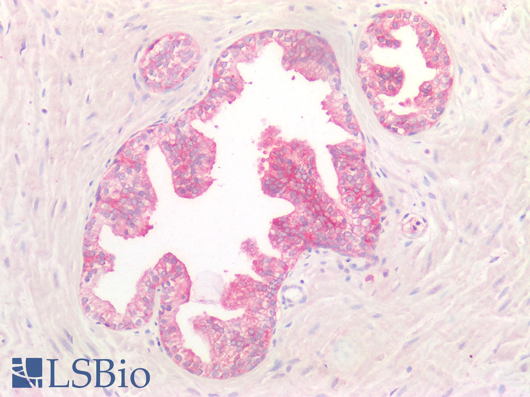 IHC-plus™ CD47 Antibody