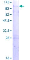 Human CIRH1A Protein (Recombinant GST)
