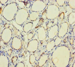 Polyclonal Rabbit anti-Human TPO / Thyroid Peroxidase Antibody (IHC)