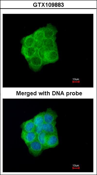 Polyclonal Rabbit anti-Human KRT13 / CK13 / Cytokeratin 13 Antibody (aa198-438, IHC, WB)