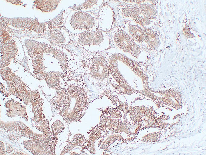 EPCAM Antibody (clone ABT-EPCAM)