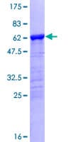 Human NBP / NUBP1 Protein (Recombinant GST)