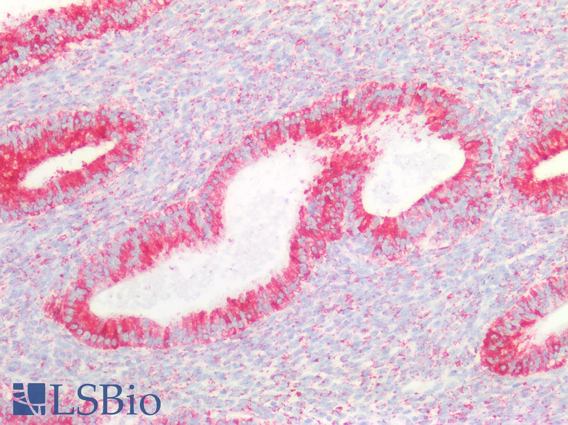 PathPlus™ CANX / Calnexin Antibody
