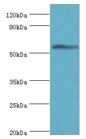 Polyclonal Rabbit anti-Human CCT3 Antibody (aa1-300, IHC, WB)