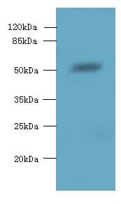Polyclonal Rabbit anti-Human SLC38A2 / SNAT2 Antibody (aa1-76, IHC, WB)