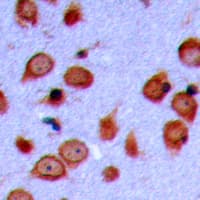 LMTK3 Antibody (C-Terminus)