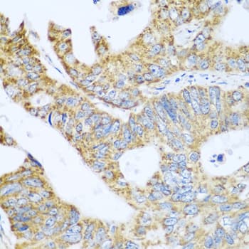 Polyclonal Rabbit anti-Human GLUD1/Glutamate Dehydrogenase Antibody (IHC, WB)