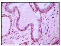 CD105 Antibody (clone 3G9D10)
