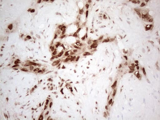 HNRNPL / hnRNP L Antibody (aa270-502, clone OTI4E5, Carrier-free)