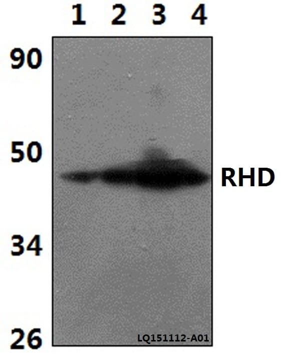 Polyclonal Rabbit anti-Human RHD Antibody (WB)