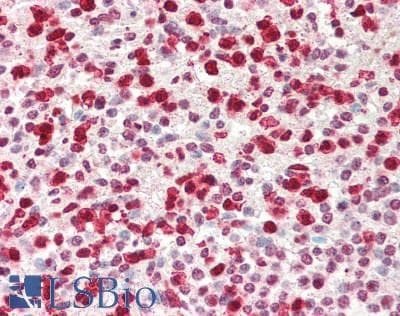 IHC-plus™ Polyclonal Rabbit anti-Human SAMHD1 Antibody (IHC, IF, WB)