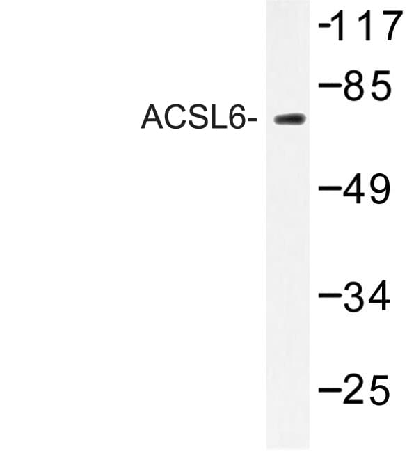 Polyclonal Rabbit anti-Human ACSL6 Antibody (Asp531, IHC, WB)