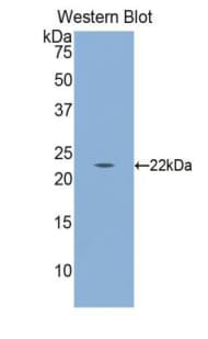 CALR / Calreticulin Antibody (aa18-193)