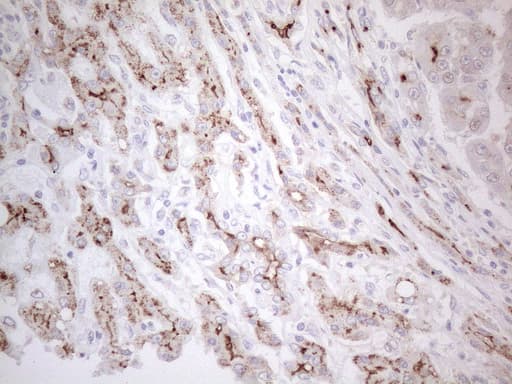 ABCB1 / MDR1 / P Glycoprotein Antibody (aa995-1280, clone OTI6E4)
