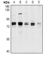 Polyclonal Rabbit anti-Human RP49 / CNG1 Antibody (WB)