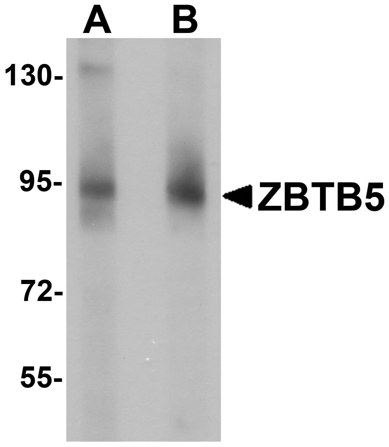 Polyclonal Rabbit anti-Human ZBTB5 Antibody (IHC, IF, WB)