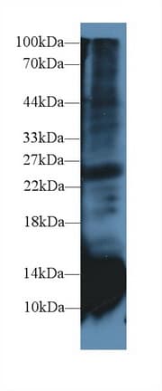 CSTB / Cystatin B / Stefin B Antibody (aa2-98)