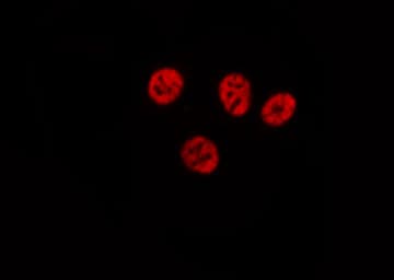 TSN / Translin Antibody