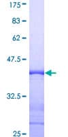 Human GOLGA2 / GM130 Protein (Recombinant GST, N-terminus)