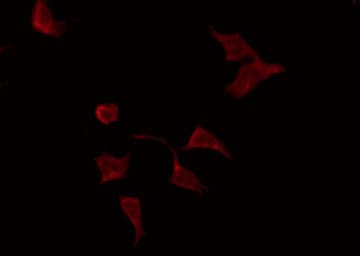 MAP2K3 / MEK3 / MKK3 Antibody