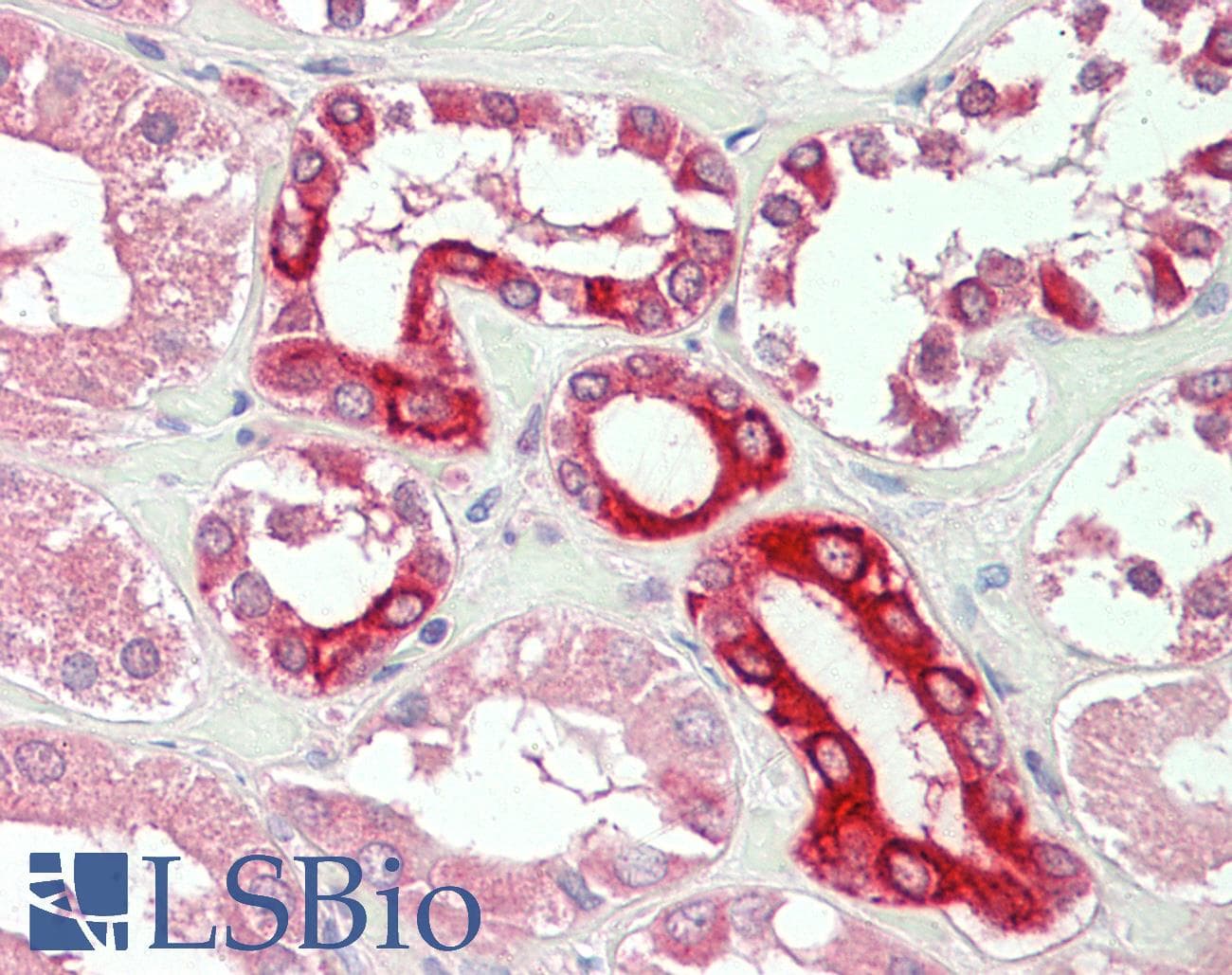 IHC-plus™ Polyclonal Goat anti-Human BOK Antibody (aa93-104, IHC)
