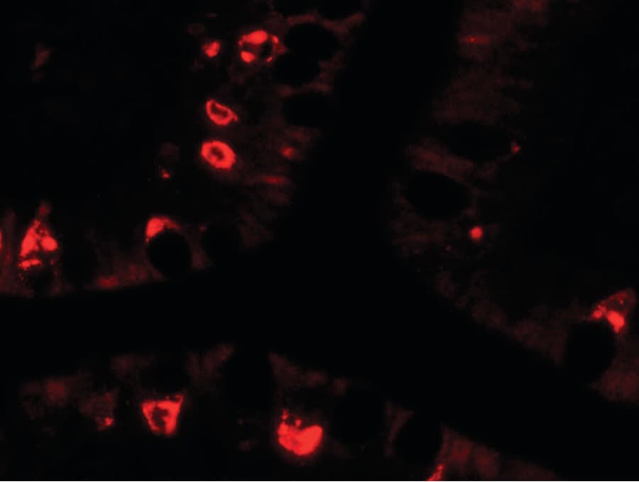 PathPlus™ AGR2 Antibody