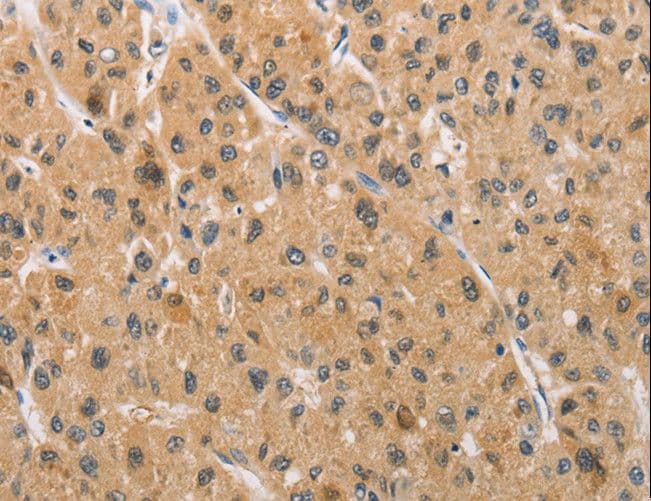 ARMCX1 Antibody