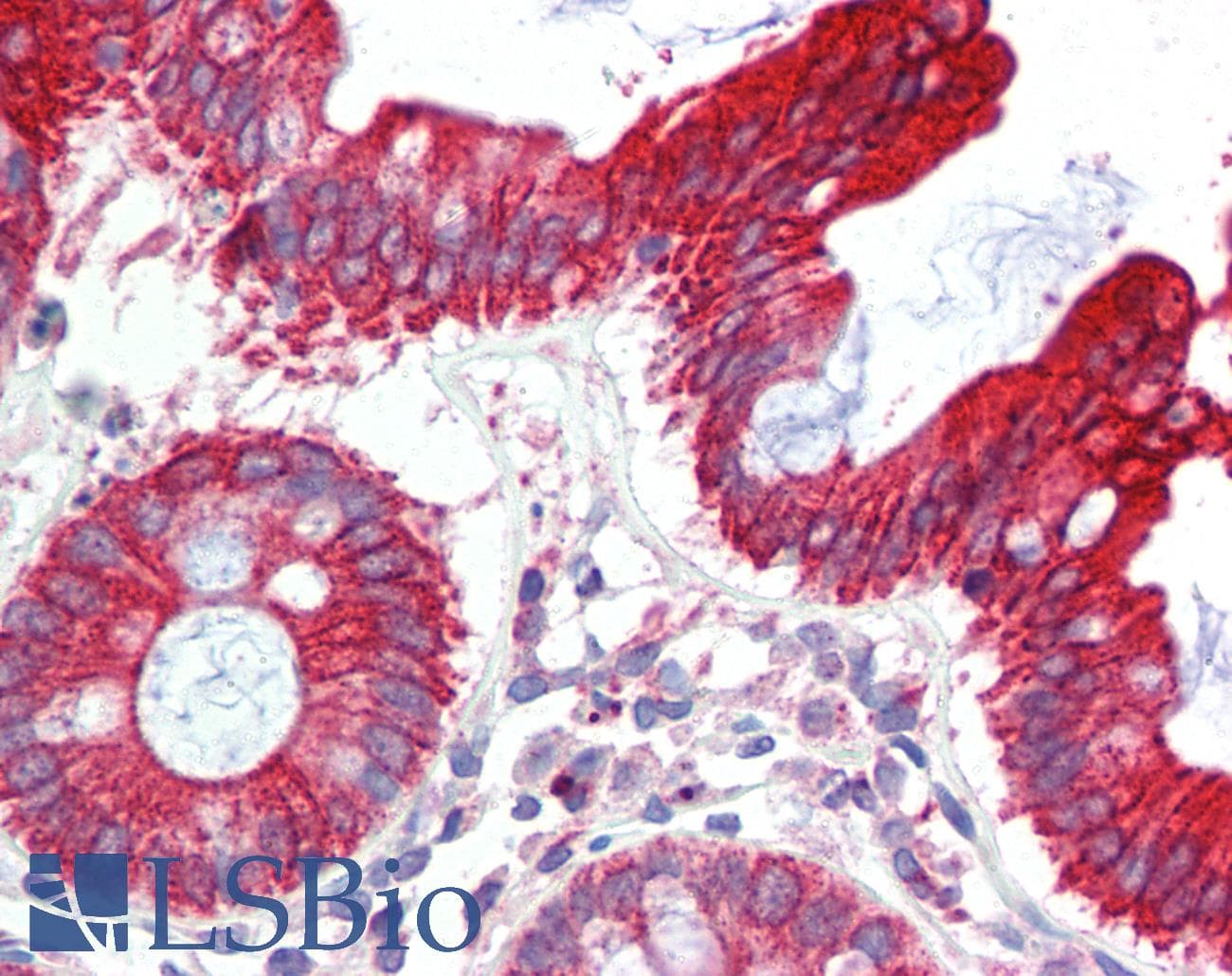 UBE2L3 / UBCH7 Antibody (C-Terminus)