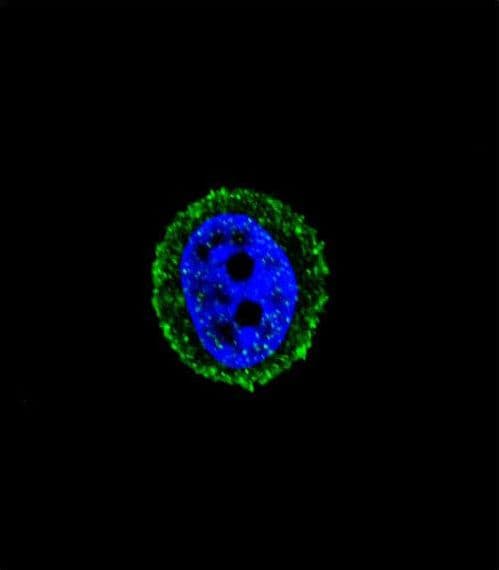 IHC-plus™ CALCR / Calcitonin Receptor Antibody (aa445-474)