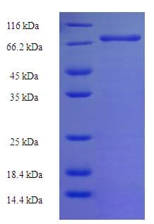 Human NLE1 Protein (Recombinant His-SUMO)