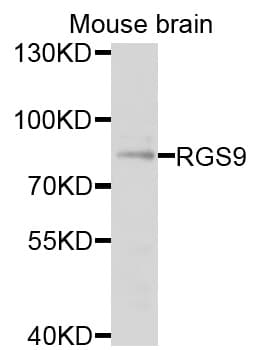 Polyclonal Rabbit anti-Human RGS9 Antibody (WB)