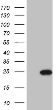 CETN3 Antibody (clone OTI2C2)