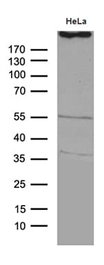 TP53BP1 / 53BP1 Antibody (aa1-300, clone OTI2G3)