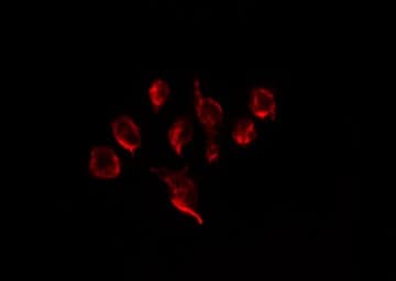 Polyclonal Rabbit anti-Human PTHR / PTHR1 Antibody (IHC, IF, WB)